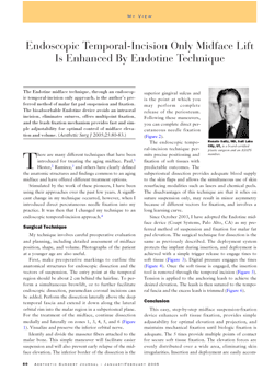 Endotine Midface Paper 5